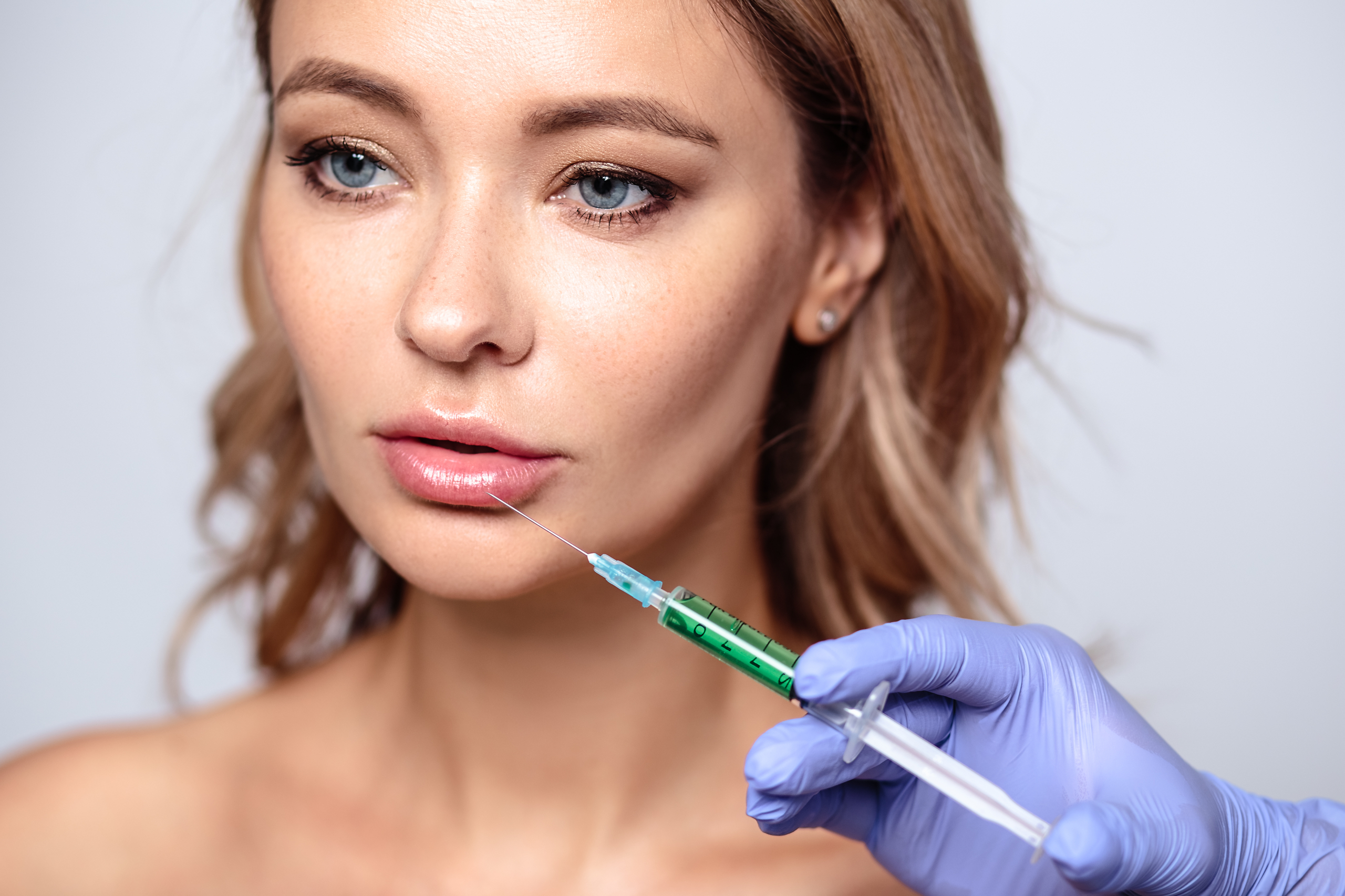 Hydroksyapatyt wapnia (RADIESSE)